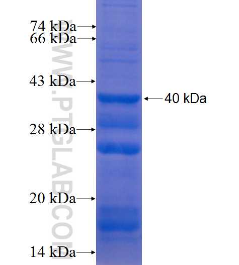 PHKA2 fusion protein Ag9473 SDS-PAGE