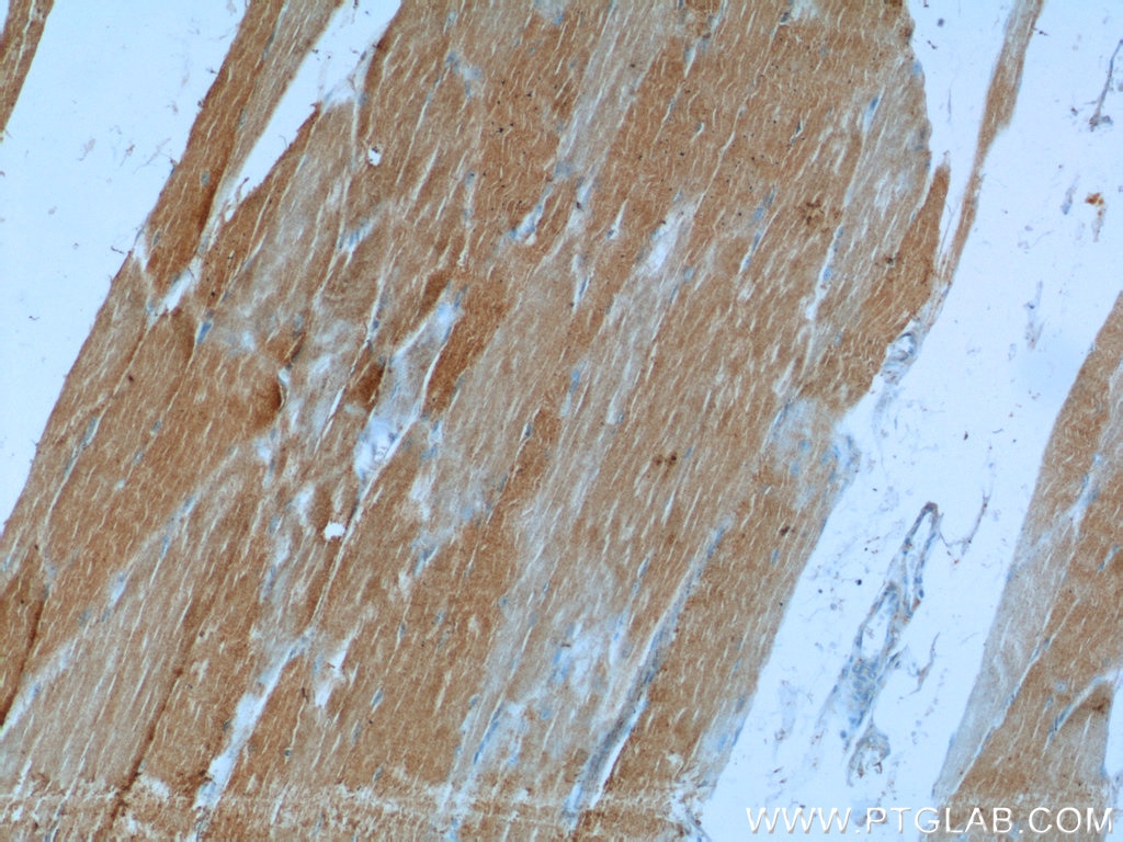 Immunohistochemistry (IHC) staining of human skeletal muscle tissue using PHKB Polyclonal antibody (13400-1-AP)