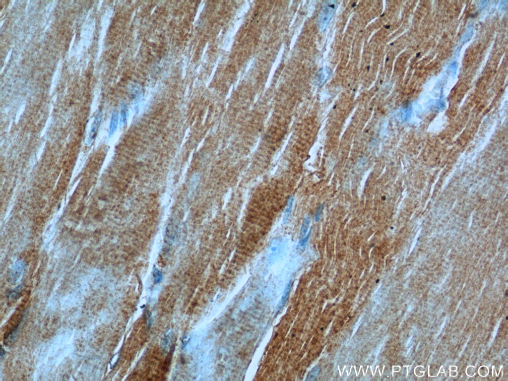 Immunohistochemistry (IHC) staining of human skeletal muscle tissue using PHKB Polyclonal antibody (13400-1-AP)