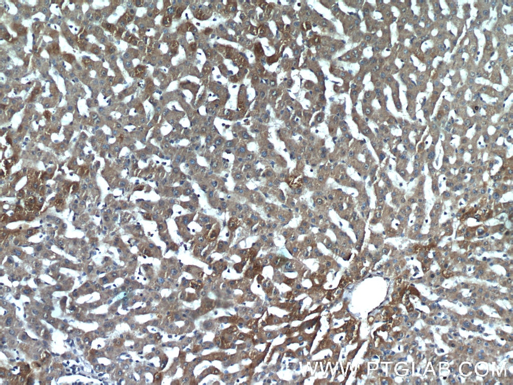 Immunohistochemistry (IHC) staining of human liver tissue using PHKB Polyclonal antibody (13400-1-AP)