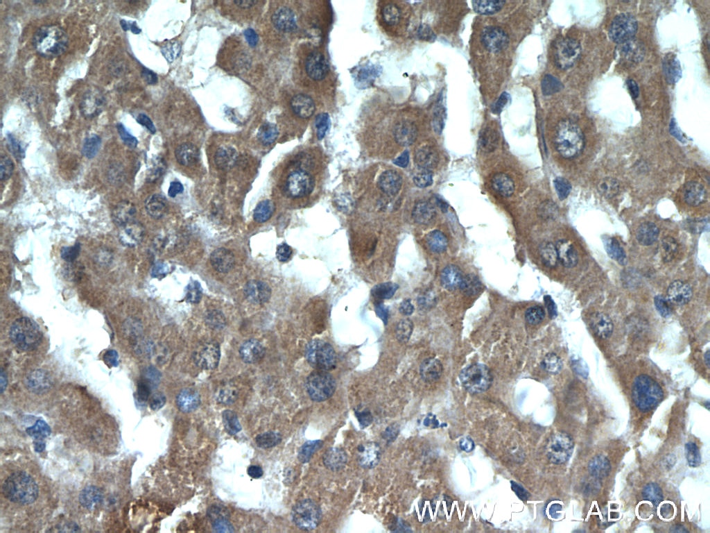 Immunohistochemistry (IHC) staining of human liver tissue using PHKB Polyclonal antibody (13400-1-AP)