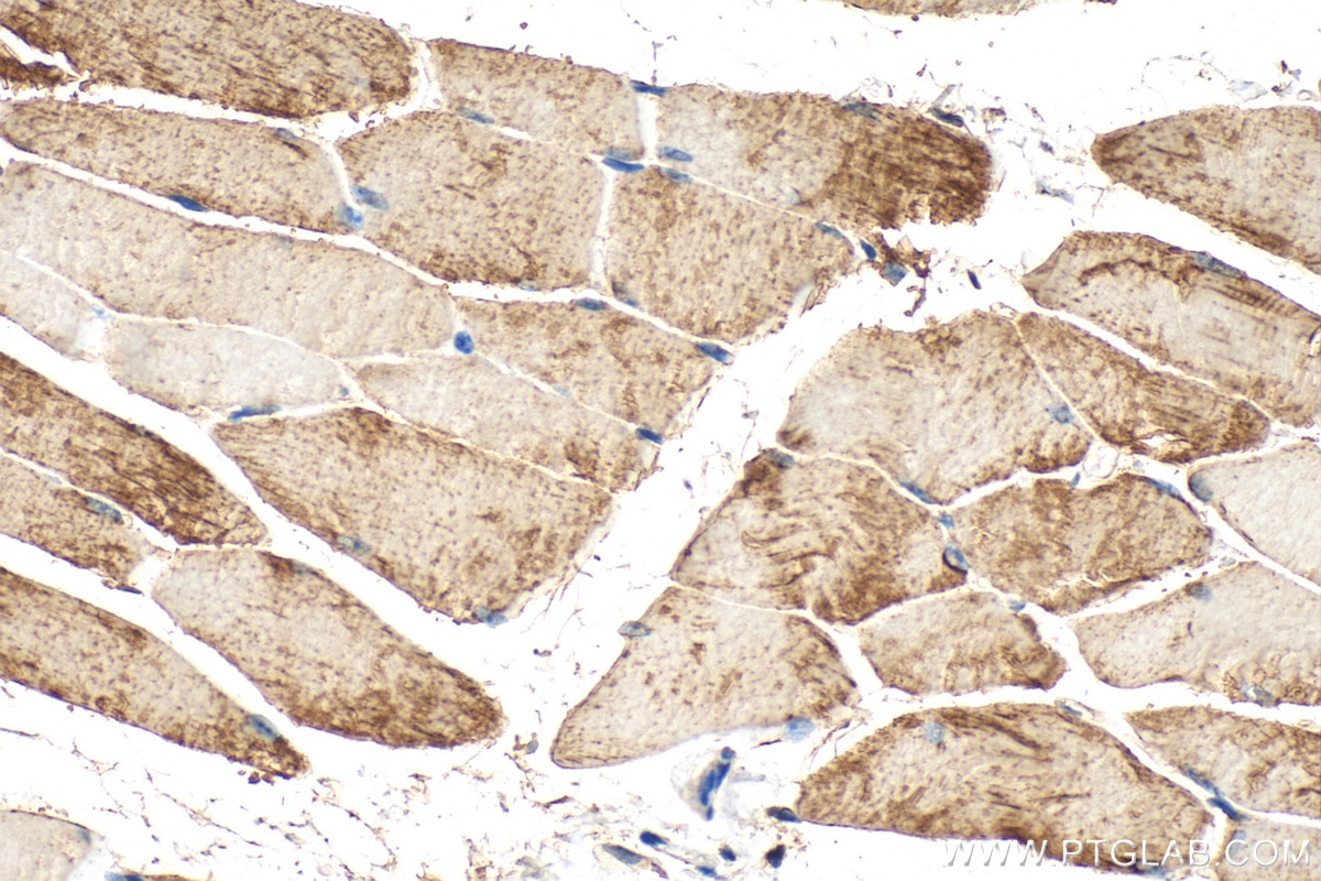 Immunohistochemistry (IHC) staining of mouse skeletal muscle tissue using PHKB Polyclonal antibody (13400-1-AP)