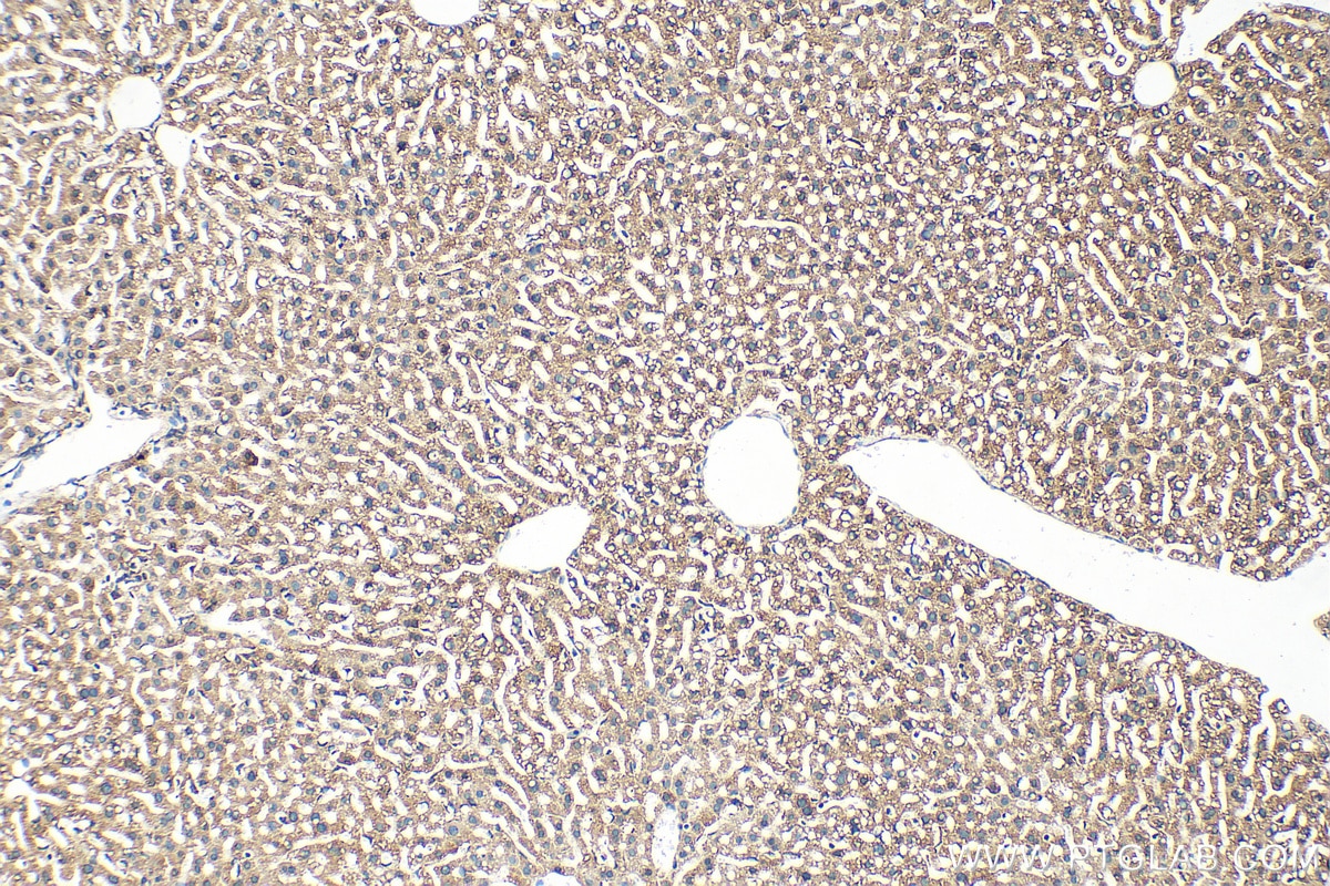 Immunohistochemistry (IHC) staining of mouse liver tissue using PHKB Polyclonal antibody (13400-1-AP)