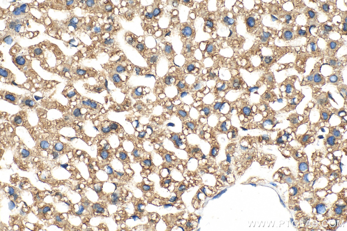 Immunohistochemistry (IHC) staining of mouse liver tissue using PHKB Polyclonal antibody (13400-1-AP)