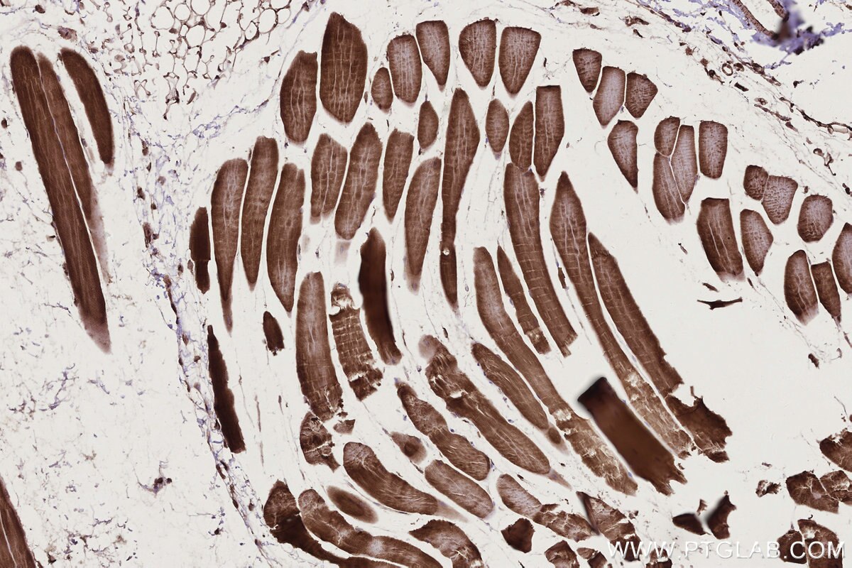 Immunohistochemistry (IHC) staining of mouse skeletal muscle tissue using PHKB Polyclonal antibody (13400-1-AP)