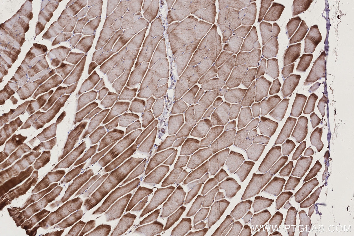 Immunohistochemistry (IHC) staining of mouse skeletal muscle tissue using PHKB Polyclonal antibody (13400-1-AP)