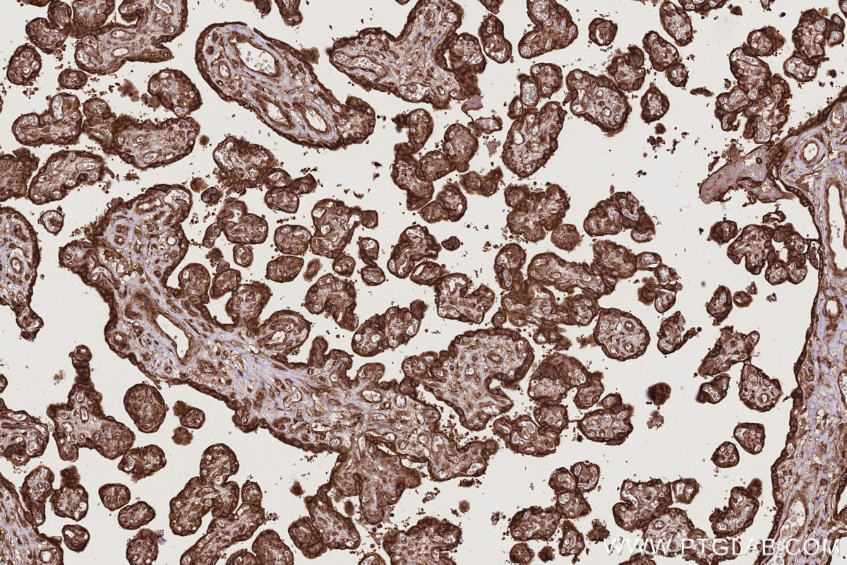 Immunohistochemistry (IHC) staining of human placenta tissue using PHKB Polyclonal antibody (13400-1-AP)