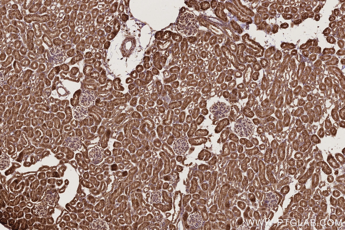 Immunohistochemistry (IHC) staining of mouse kidney tissue using PHKB Polyclonal antibody (13400-1-AP)