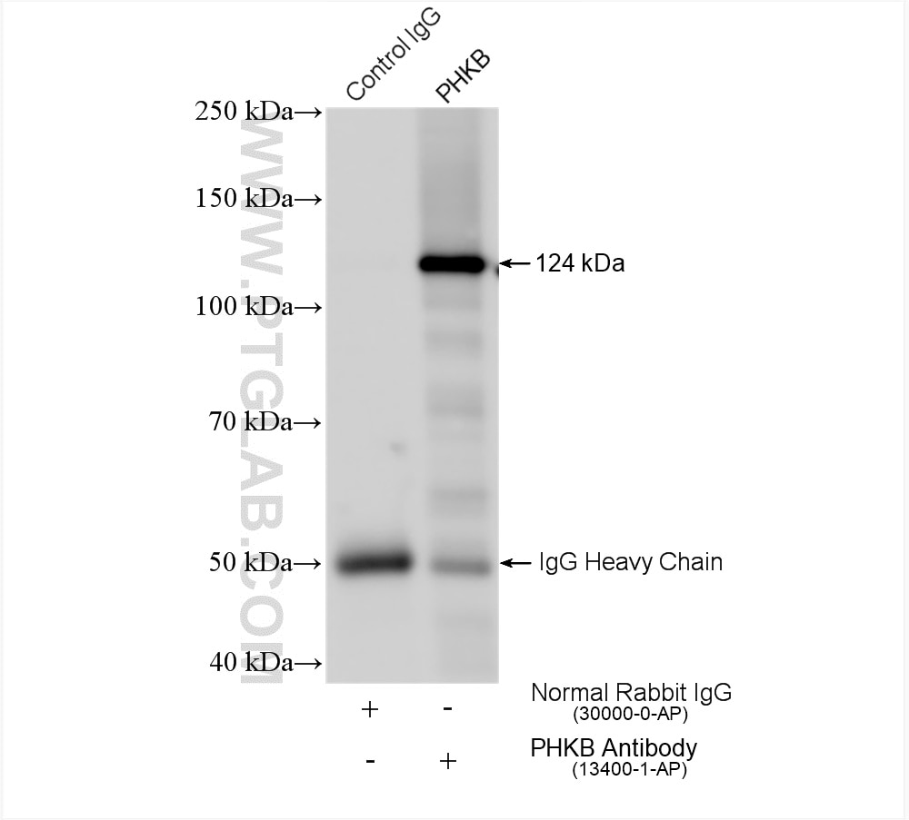 Immunoprecipitation (IP) experiment of mouse heart tissue using PHKB Polyclonal antibody (13400-1-AP)