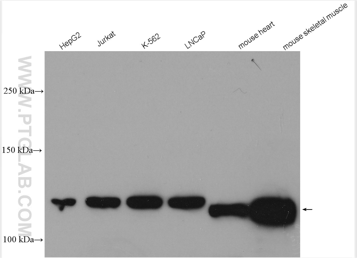 Western Blot (WB) analysis of HepG2 cells using PHKB Polyclonal antibody (13400-1-AP)