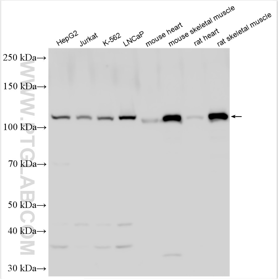 Western Blot (WB) analysis of various lysates using PHKB Polyclonal antibody (13400-1-AP)