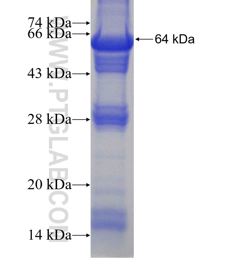 PHKB fusion protein Ag4240 SDS-PAGE