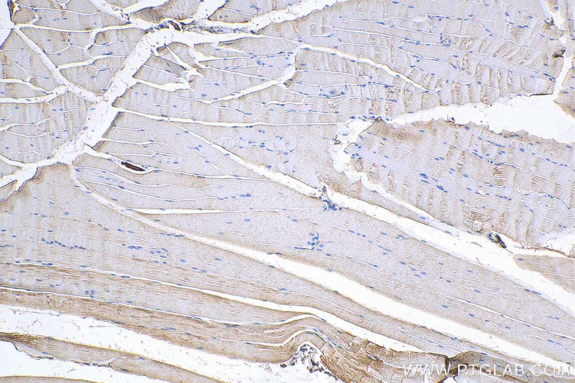 Immunohistochemistry (IHC) staining of mouse skeletal muscle tissue using PHKG1 Polyclonal antibody (16743-1-AP)