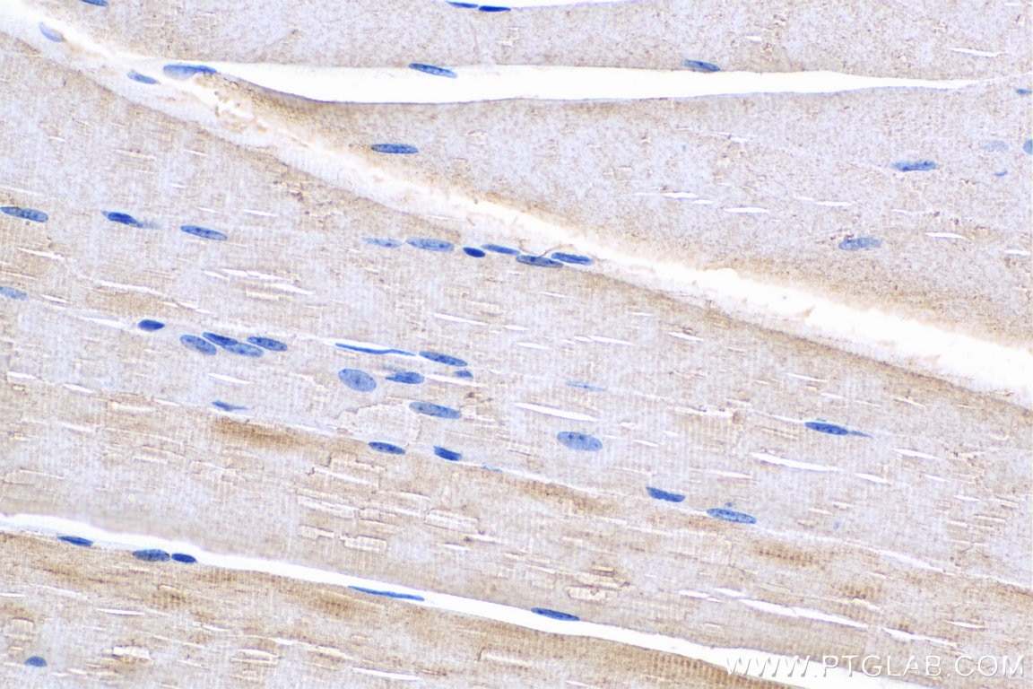 Immunohistochemistry (IHC) staining of mouse skeletal muscle tissue using PHKG1 Polyclonal antibody (16743-1-AP)