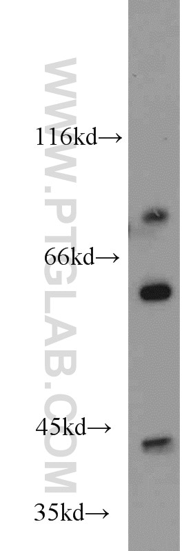 Western Blot (WB) analysis of mouse skeletal muscle tissue using PHKG1 Polyclonal antibody (16743-1-AP)