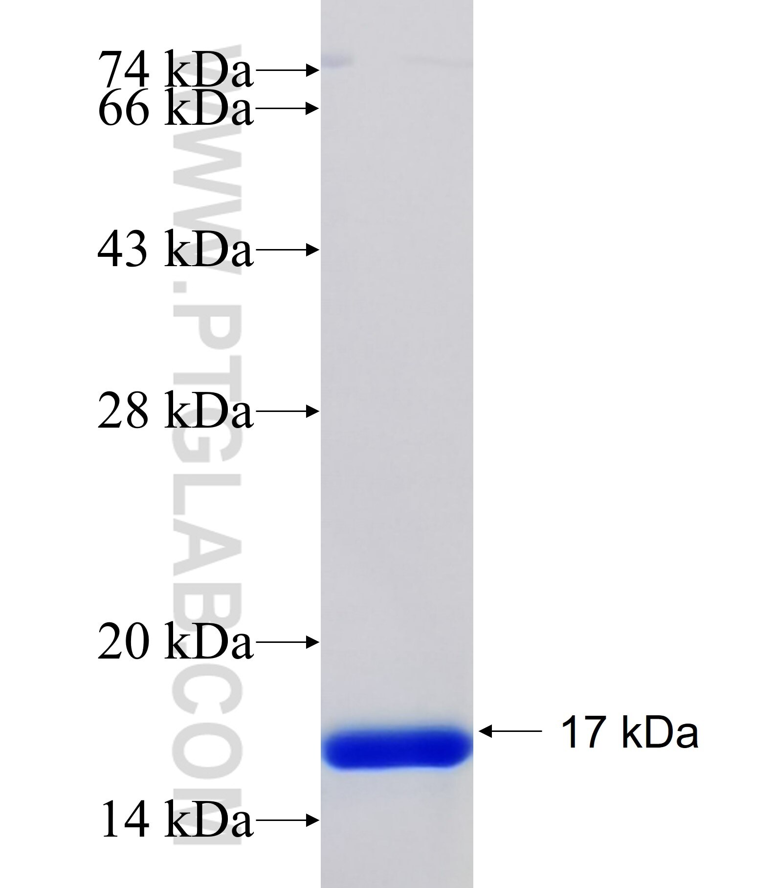 PHKG1 fusion protein Ag34236 SDS-PAGE