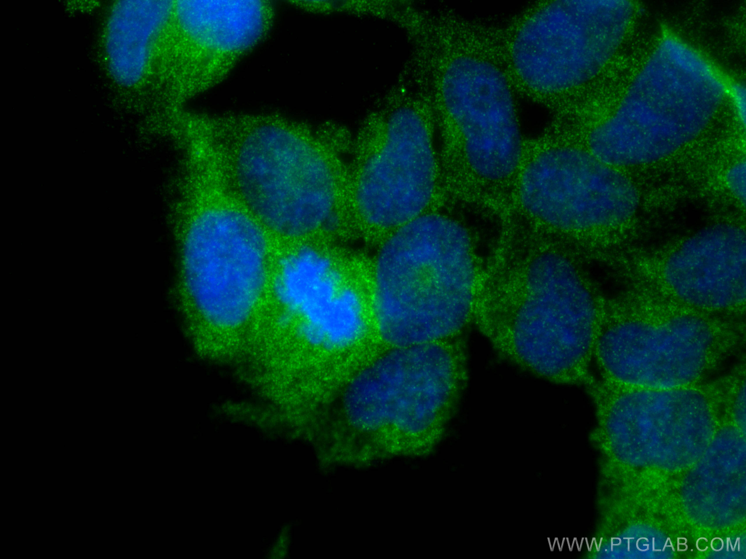 Immunofluorescence (IF) / fluorescent staining of HEK-293 cells using PHKG2 Polyclonal antibody (15109-1-AP)