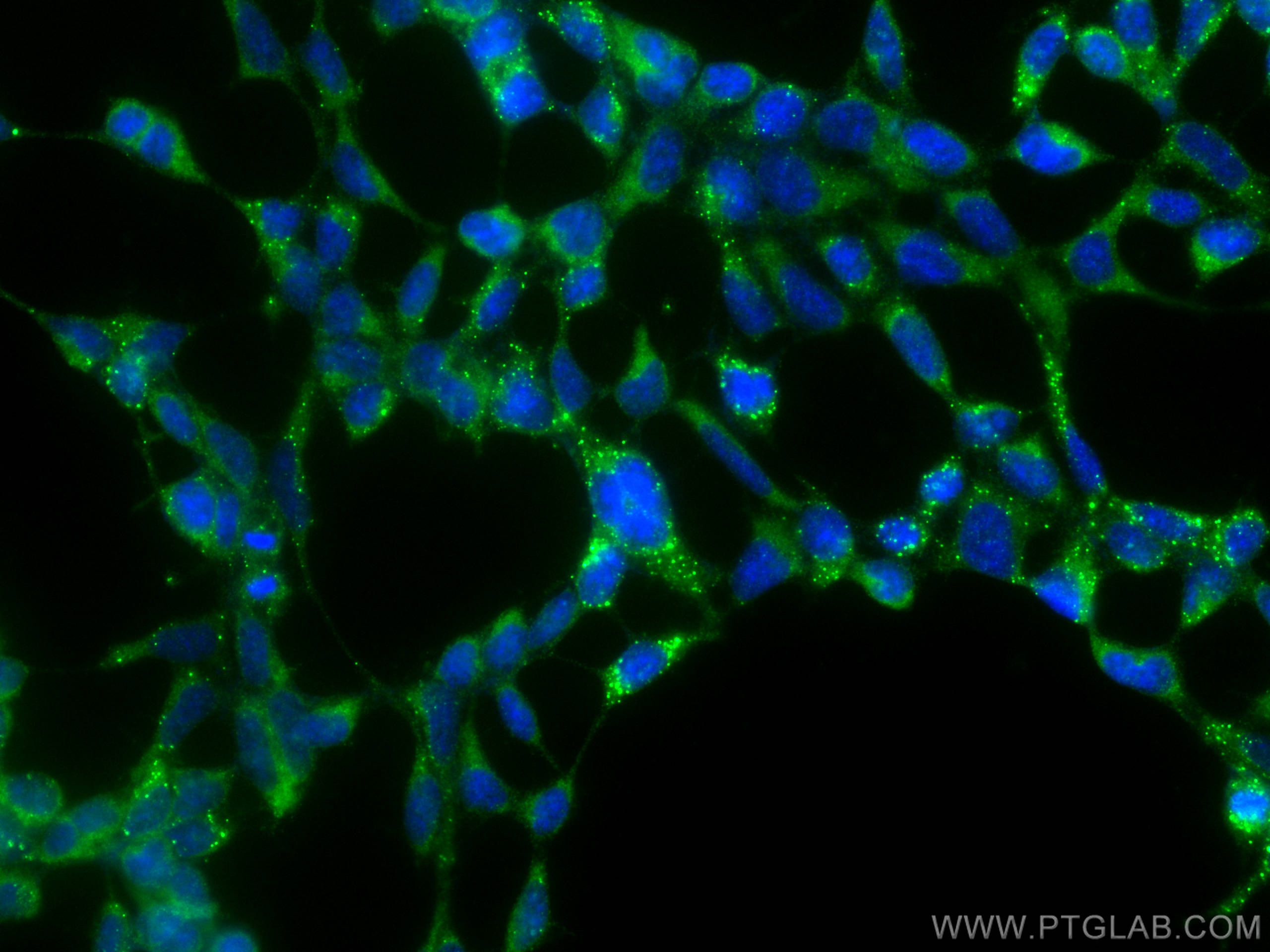 Immunofluorescence (IF) / fluorescent staining of HEK-293 cells using PHKG2 Polyclonal antibody (15109-1-AP)