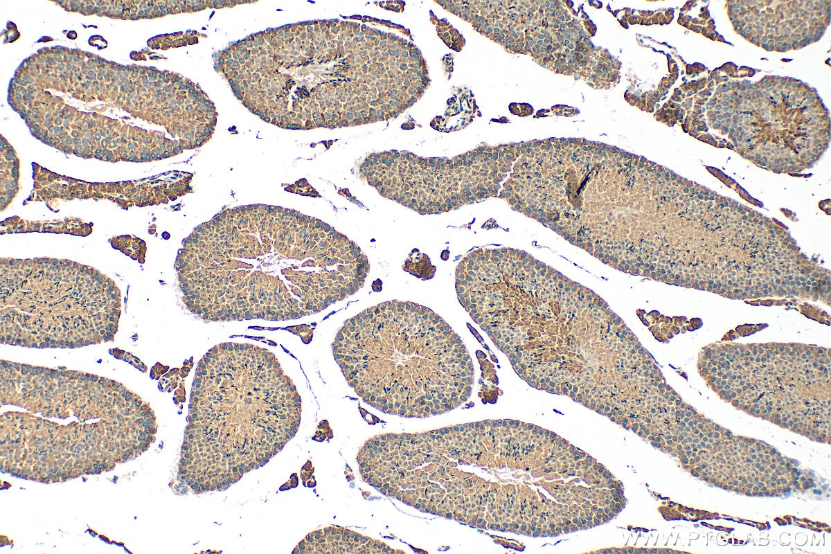 Immunohistochemistry (IHC) staining of mouse testis tissue using PHKG2 Polyclonal antibody (15109-1-AP)