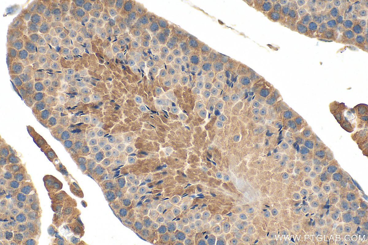 Immunohistochemistry (IHC) staining of mouse testis tissue using PHKG2 Polyclonal antibody (15109-1-AP)