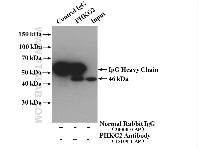 Immunoprecipitation (IP) experiment of HEK-293 cells using PHKG2 Polyclonal antibody (15109-1-AP)