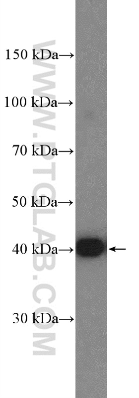 Western Blot (WB) analysis of HEK-293 cells using PHKG2 Polyclonal antibody (15109-1-AP)