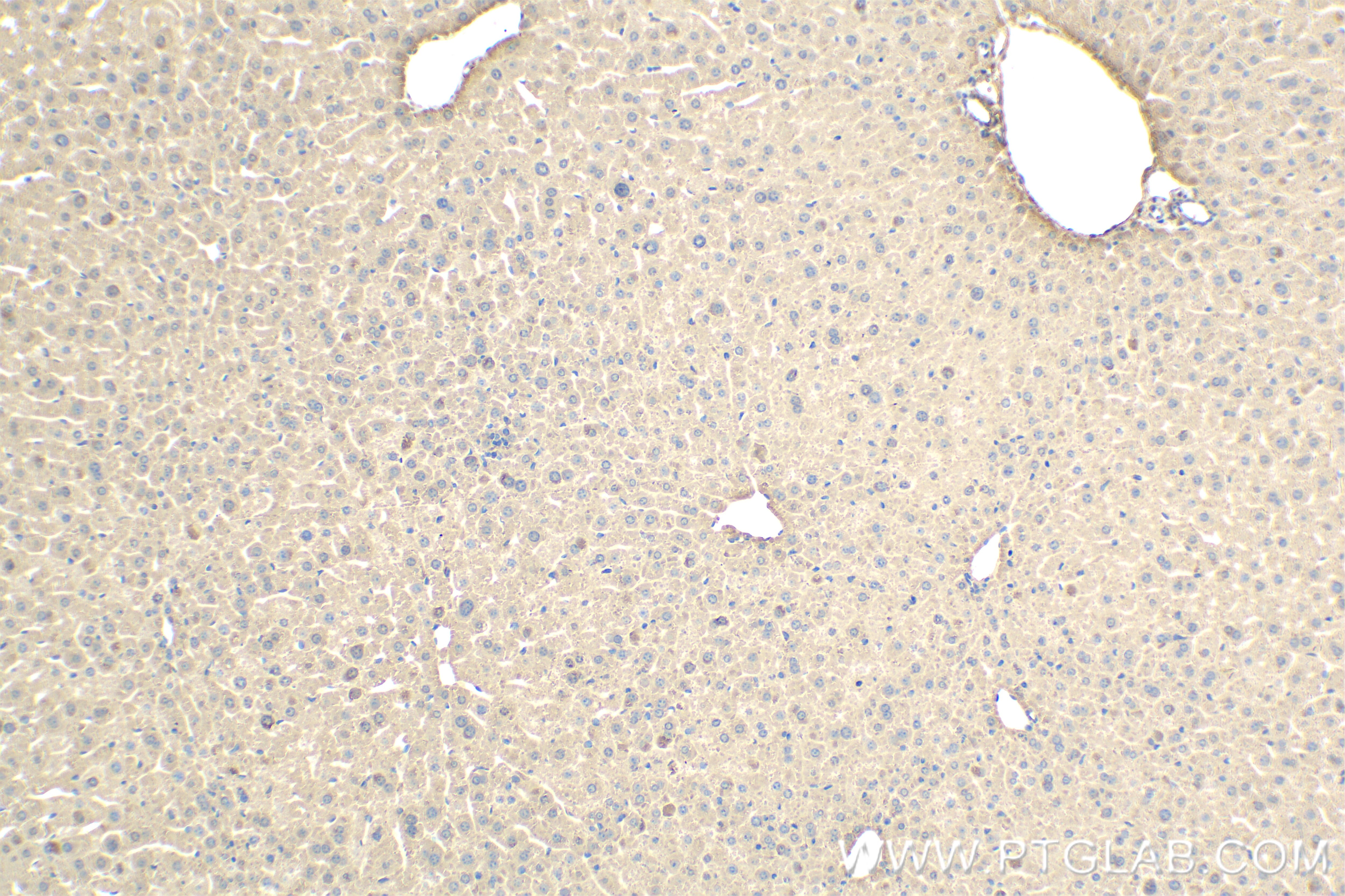 Immunohistochemistry (IHC) staining of mouse liver tissue using PHKG2 Recombinant antibody (83663-2-RR)