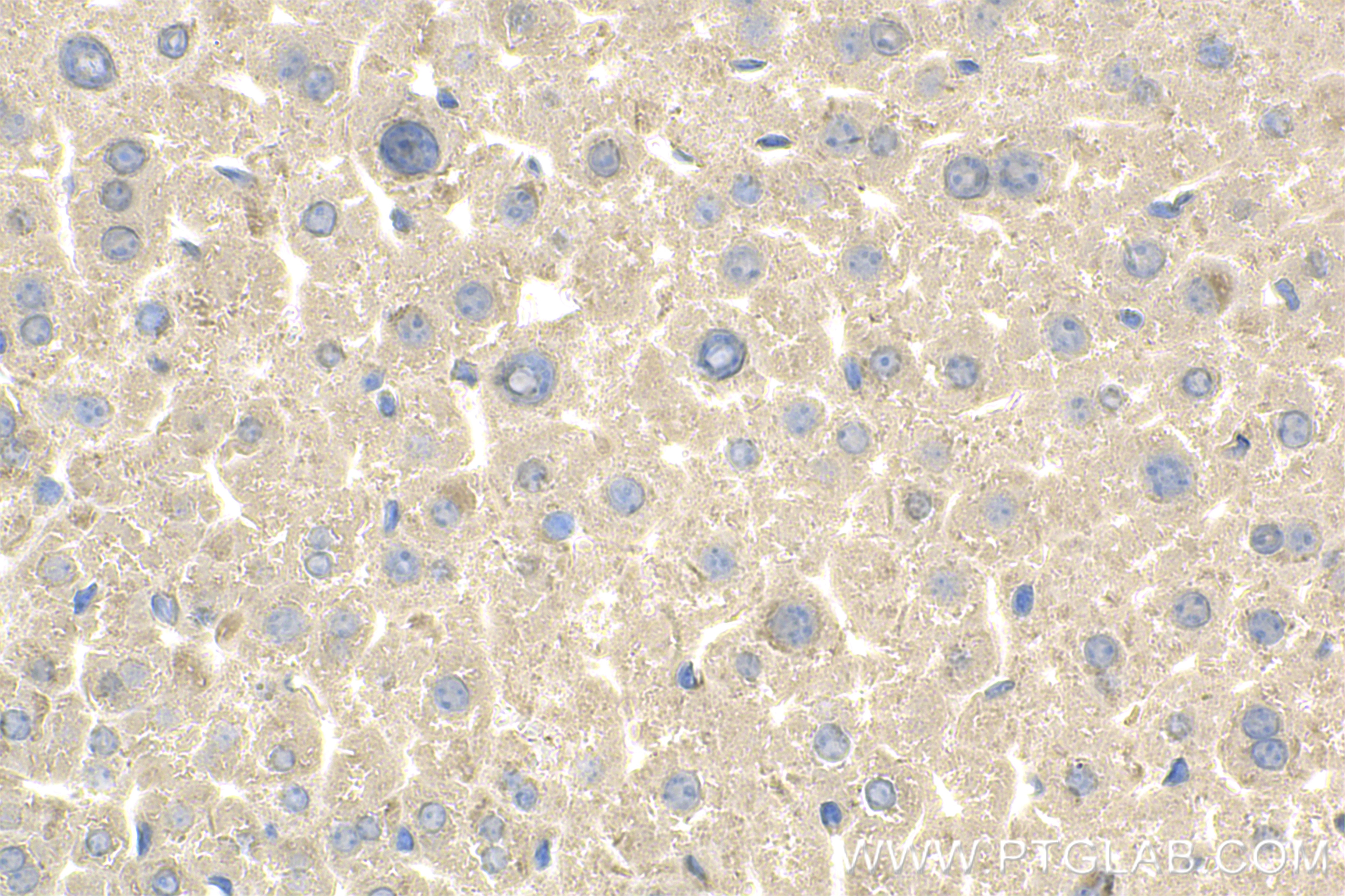 Immunohistochemistry (IHC) staining of mouse liver tissue using PHKG2 Recombinant antibody (83663-2-RR)