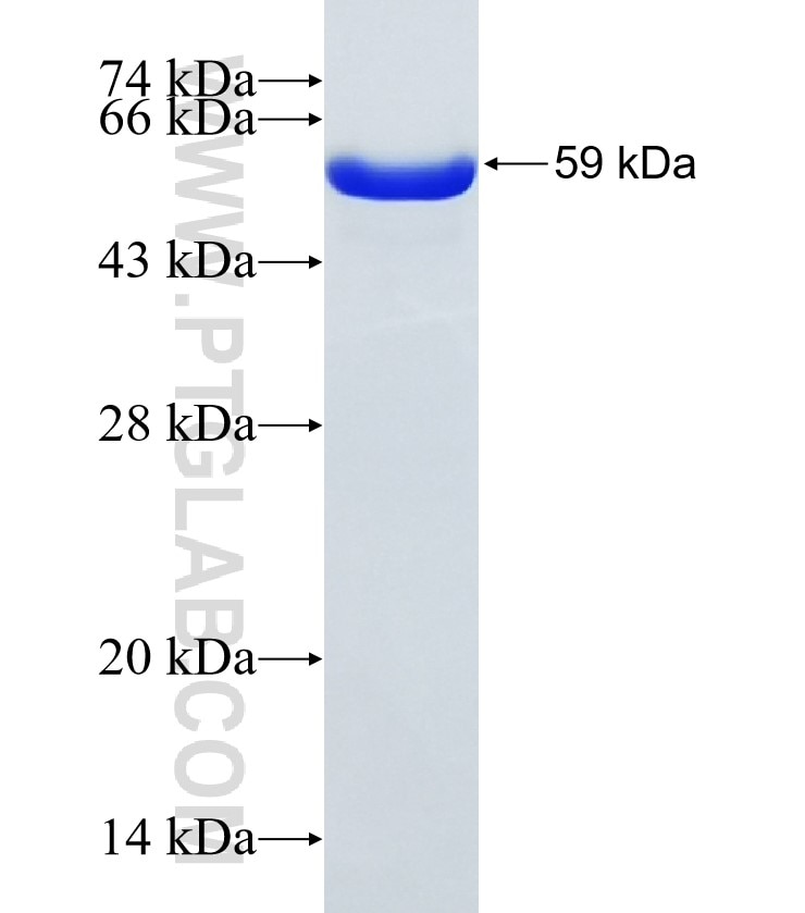 PHKG2 fusion protein Ag6829 SDS-PAGE