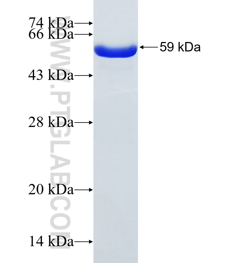 PHKG2 fusion protein Ag6829 SDS-PAGE