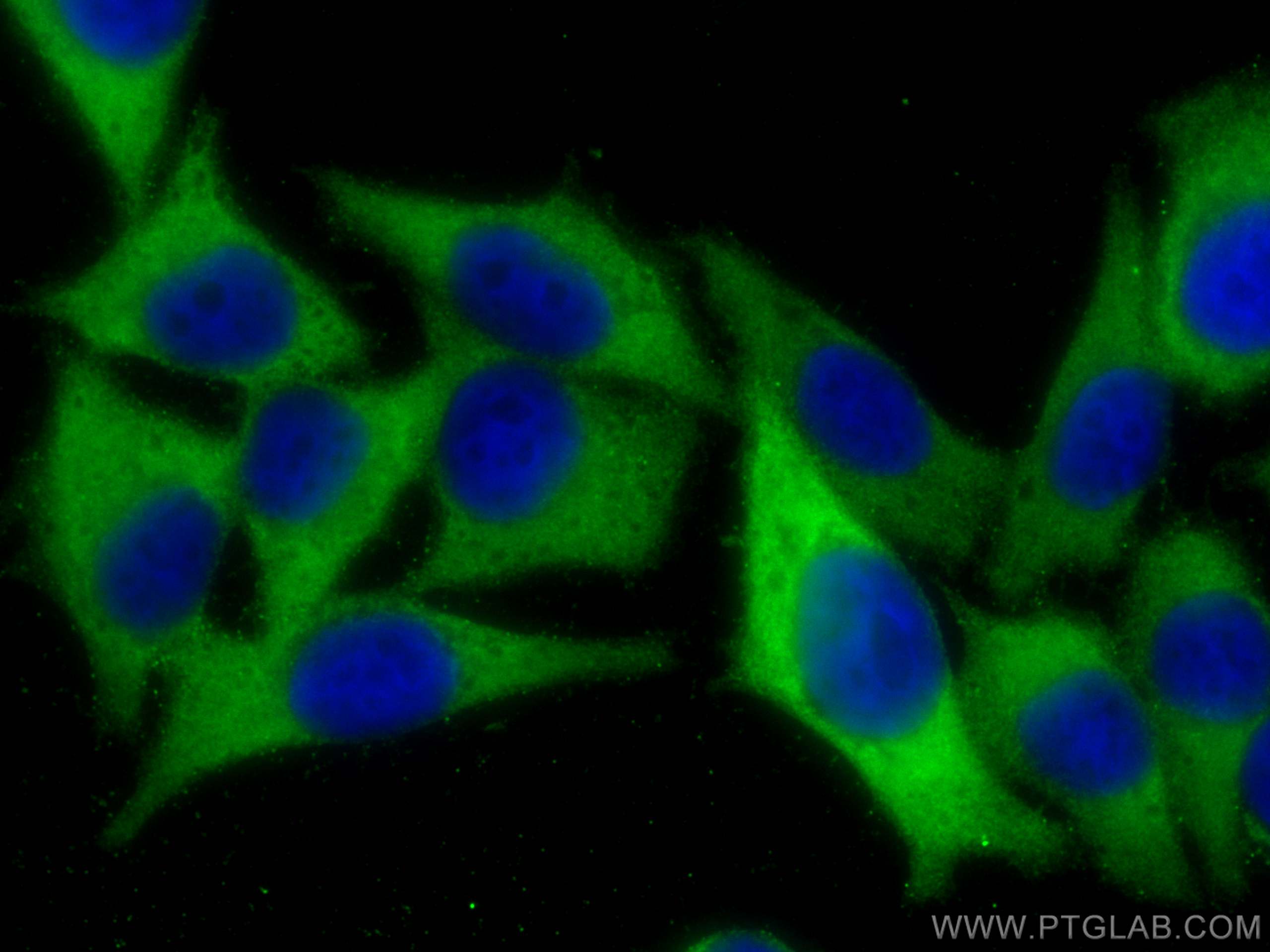 IF Staining of A375 using 18263-1-AP