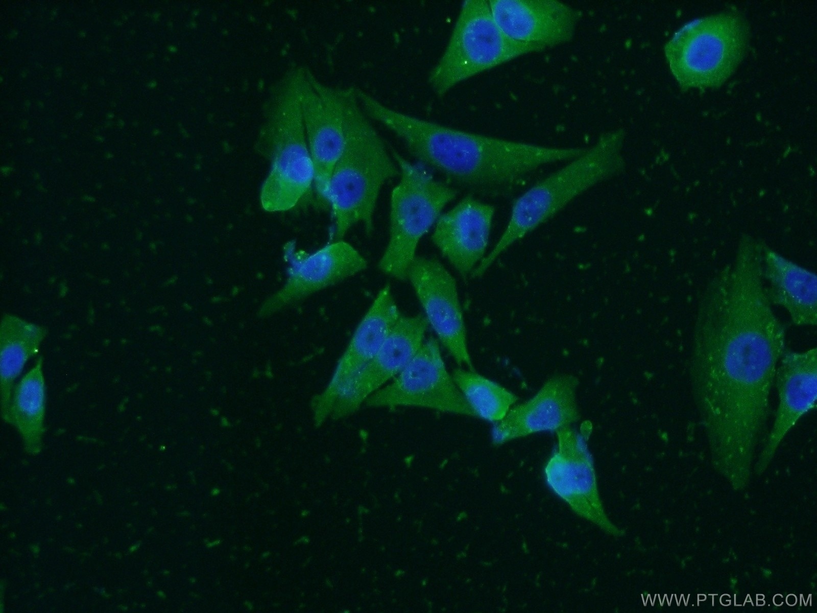 Immunofluorescence (IF) / fluorescent staining of A375 cells using PHLDA1 Polyclonal antibody (18263-1-AP)