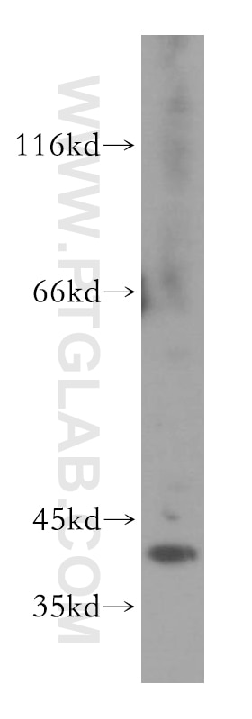 Western Blot (WB) analysis of mouse brain tissue using PHLDA1 Polyclonal antibody (18263-1-AP)