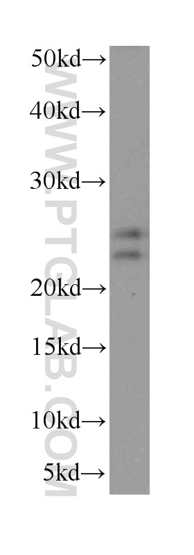 WB analysis of PC-3 using 14661-1-AP