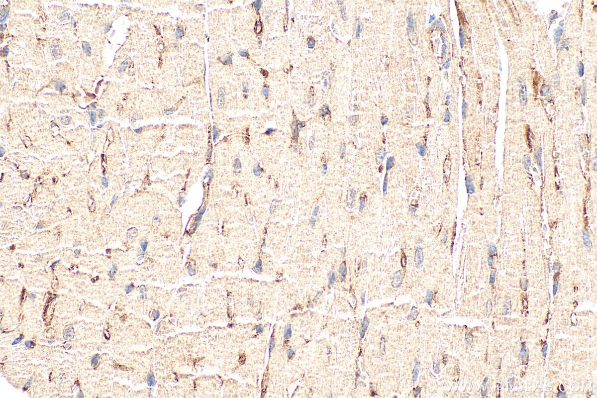 Immunohistochemistry (IHC) staining of mouse heart tissue using PHLDB1 Polyclonal antibody (33225-1-AP)