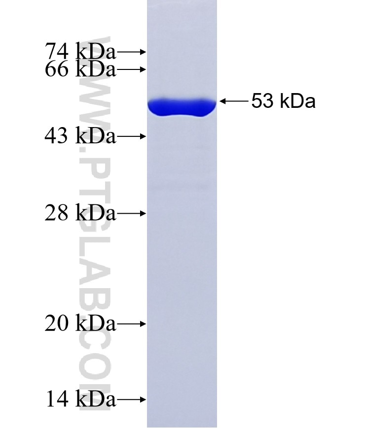 PHLDB1 fusion protein Ag37254 SDS-PAGE PHLDB1 fusion protein Ag37254 SDS-PAGE