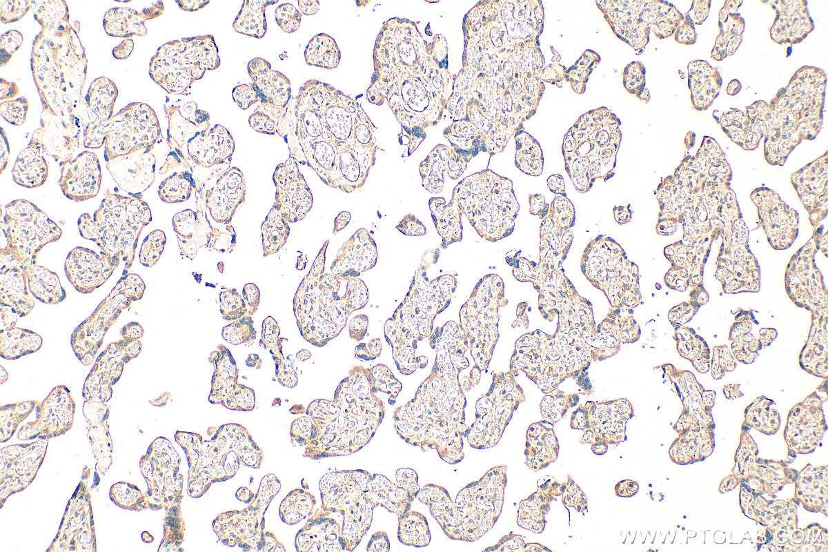 Immunohistochemistry (IHC) staining of human placenta tissue using PHLDB2 Polyclonal antibody (27940-1-AP)