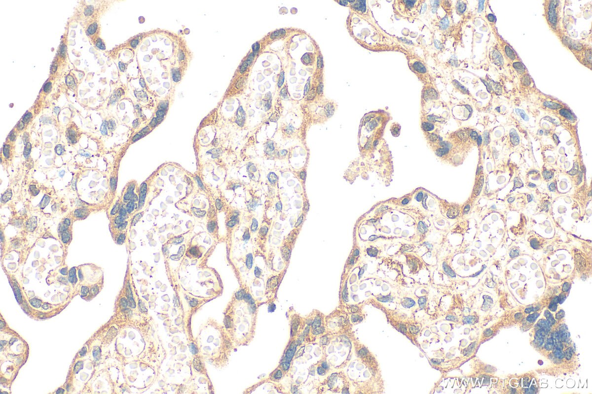 Immunohistochemistry (IHC) staining of human placenta tissue using PHLDB2 Polyclonal antibody (27940-1-AP)