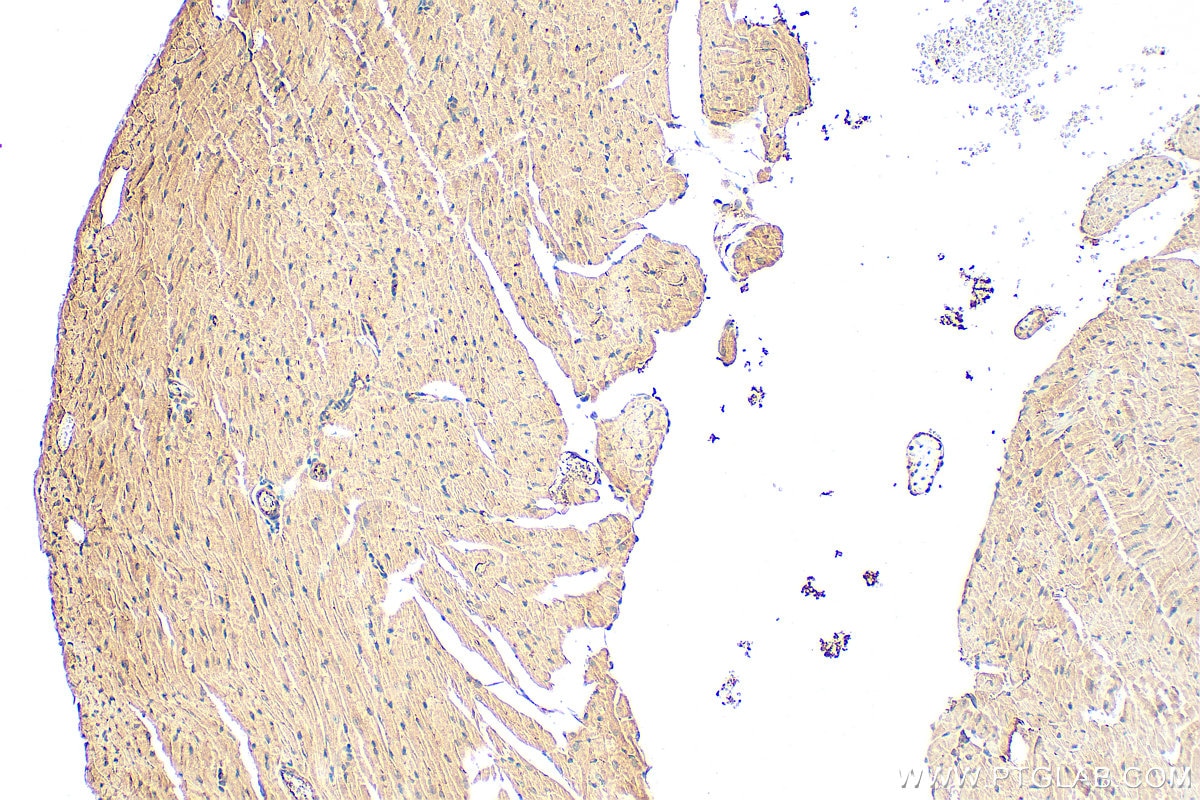 Immunohistochemistry (IHC) staining of mouse heart tissue using PHLDB2 Polyclonal antibody (27940-1-AP)