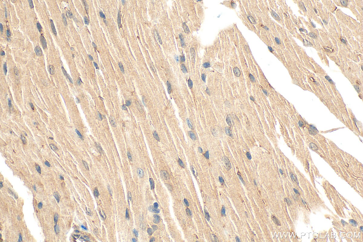 Immunohistochemistry (IHC) staining of mouse heart tissue using PHLDB2 Polyclonal antibody (27940-1-AP)