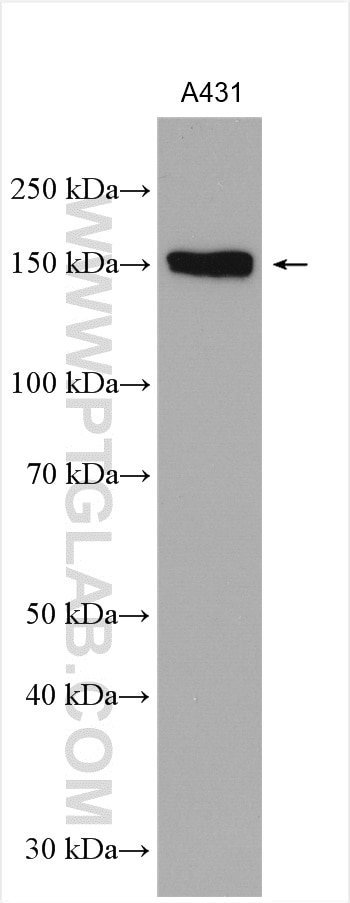 Western Blot (WB) analysis of A431 cells using PHLDB2 Polyclonal antibody (27940-1-AP)