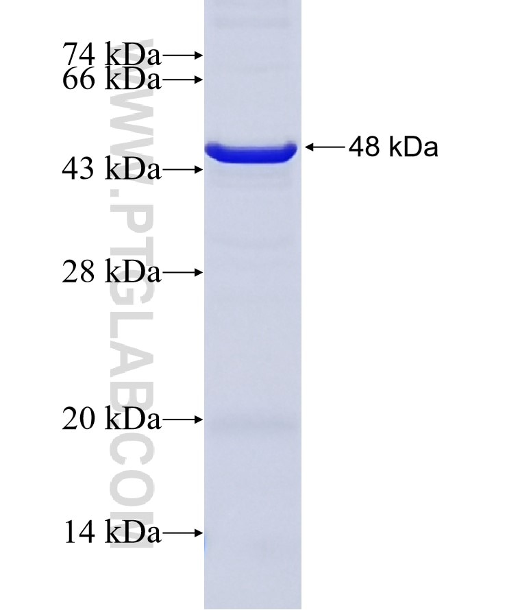 PHLDB2 fusion protein Ag27331 SDS-PAGE
