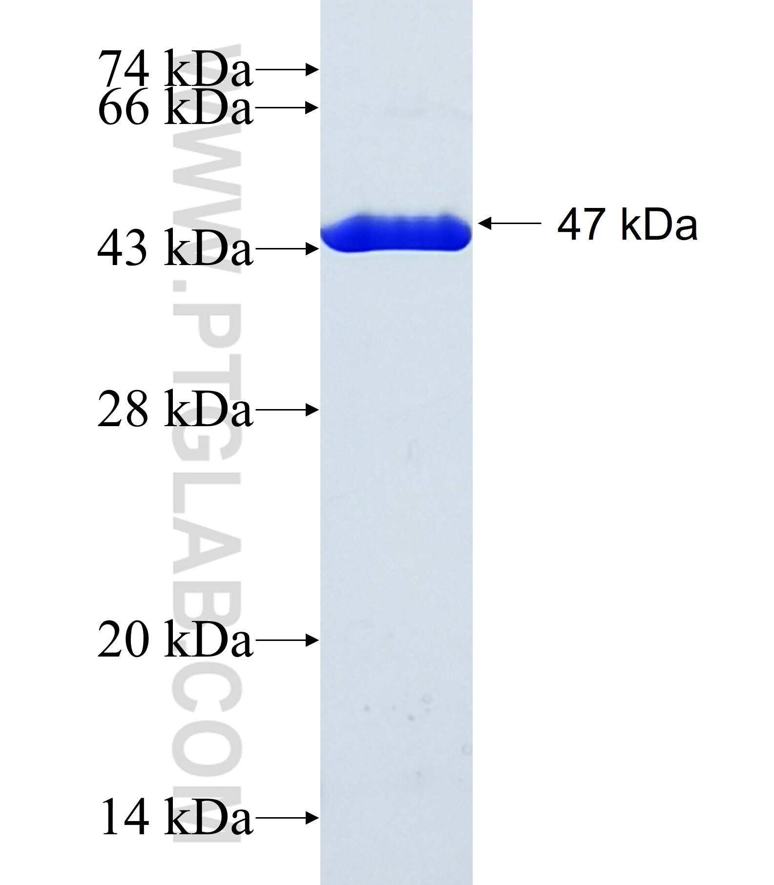 PHLDB3 fusion protein Ag38705 SDS-PAGE PHLDB3 fusion protein Ag38705 SDS-PAGE
