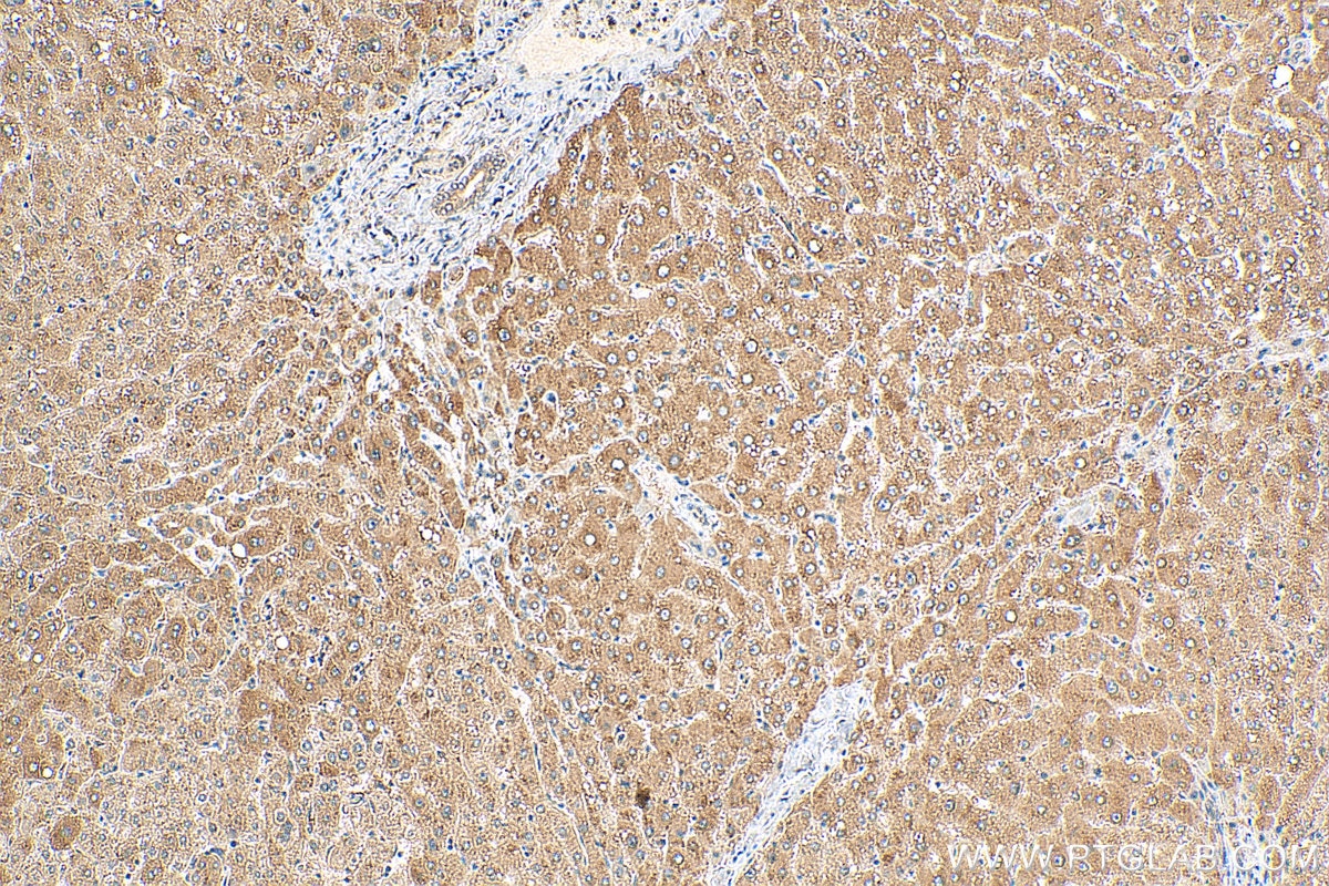 Immunohistochemistry (IHC) staining of human liver tissue using PHLPP Polyclonal antibody (22789-1-AP)