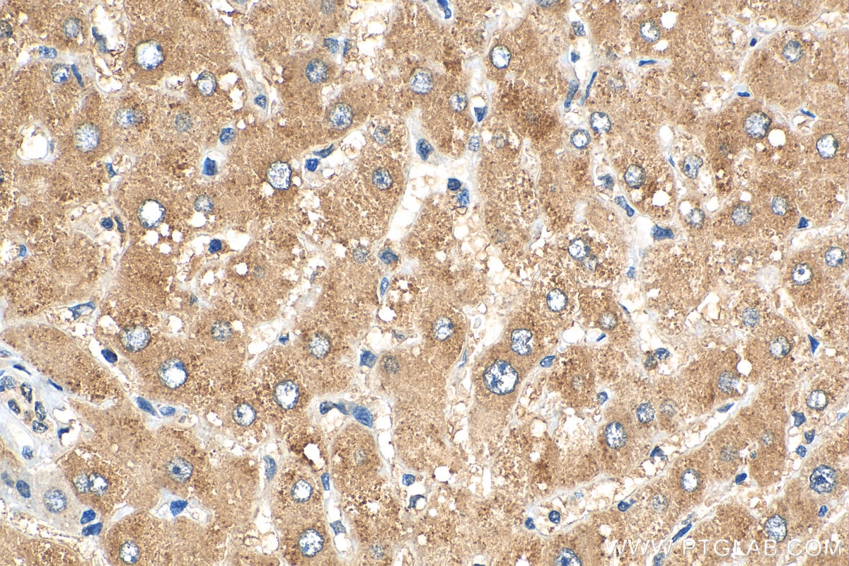 Immunohistochemistry (IHC) staining of human liver tissue using PHLPP Polyclonal antibody (22789-1-AP)
