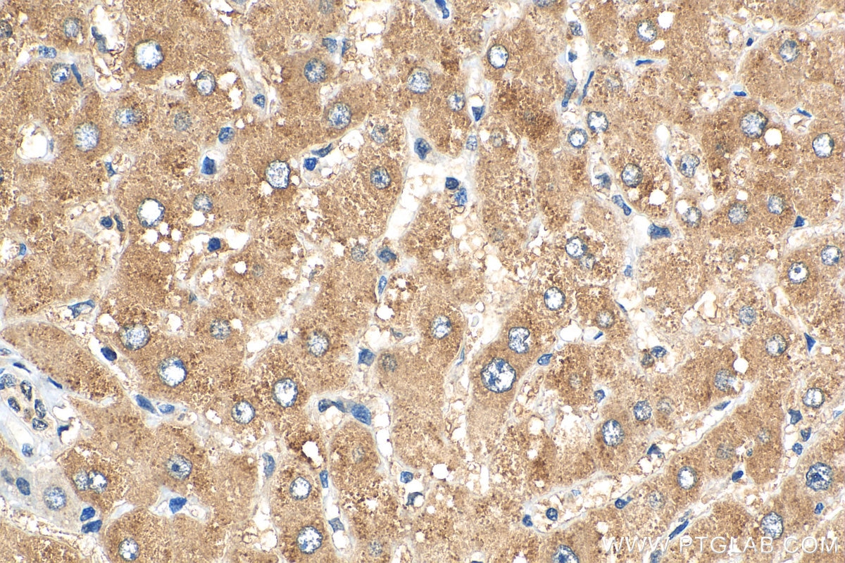 Immunohistochemistry (IHC) staining of human liver tissue using PHLPP Polyclonal antibody (22789-1-AP)