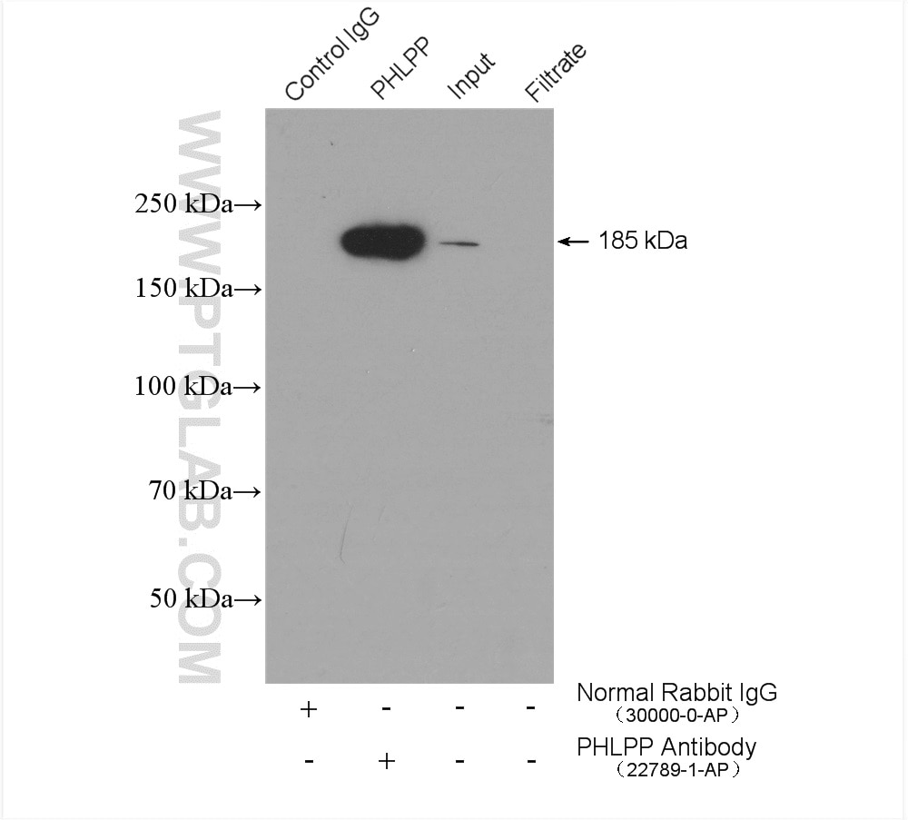 Immunoprecipitation (IP) experiment of mouse brain tissue using PHLPP Polyclonal antibody (22789-1-AP)