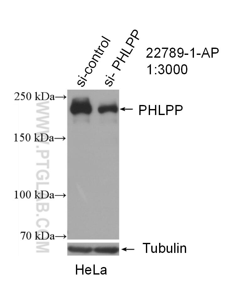 Western Blot (WB) analysis of HeLa cells using PHLPP Polyclonal antibody (22789-1-AP)