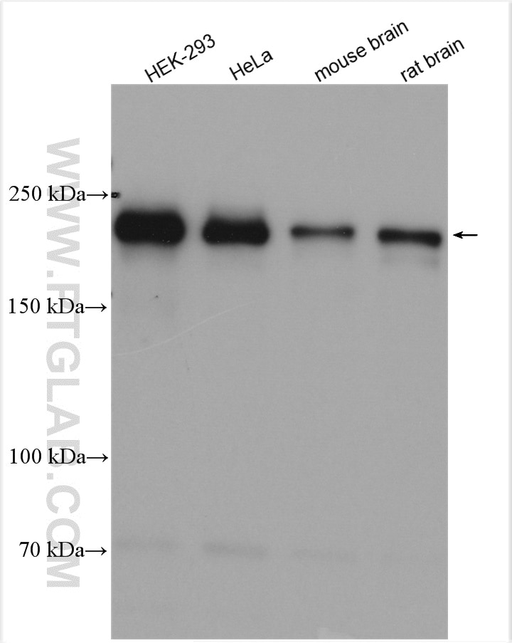 Western Blot (WB) analysis of various lysates using PHLPP Polyclonal antibody (22789-1-AP)