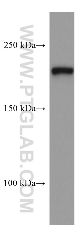 Western Blot (WB) analysis of mouse brain tissue using PHLPP Monoclonal antibody (67640-1-Ig)